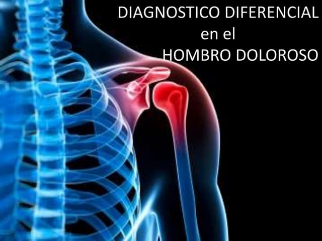 Presentazion hombro doloroso
