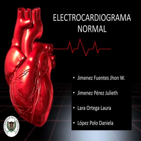 Electrocardiograma