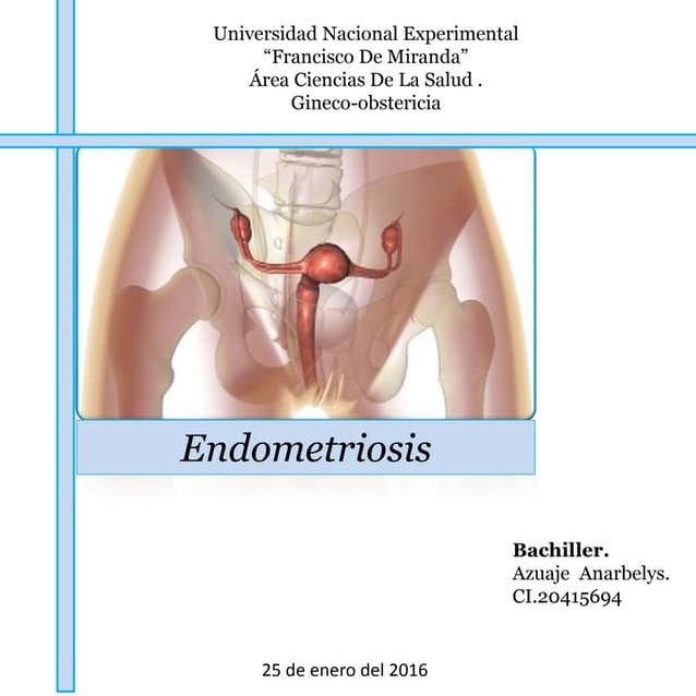 Endometriosis. GINECOLOGIA.