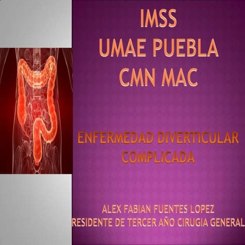 Enfermedad diverticular complicada