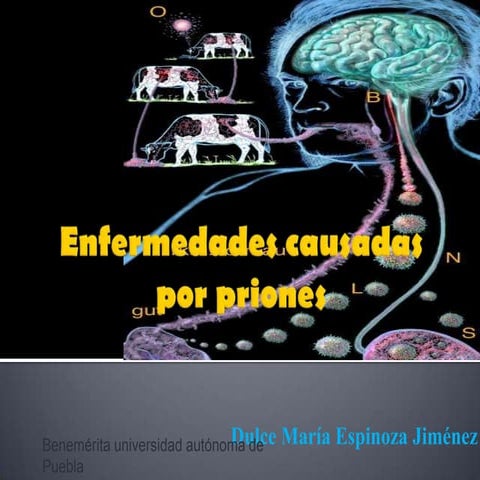 Enfermedades causadas por priones