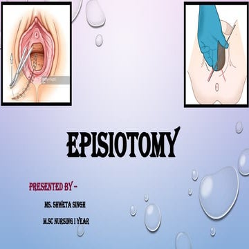 Episiotomy.pptx Shweta singh M.sc nursing