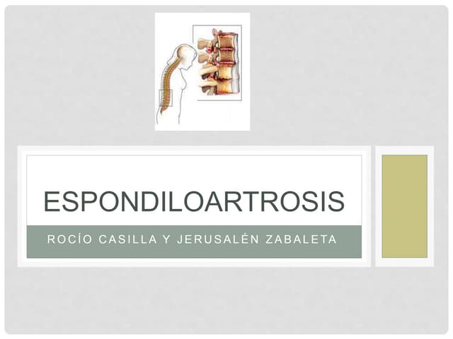 Espondiloartrosis (1)