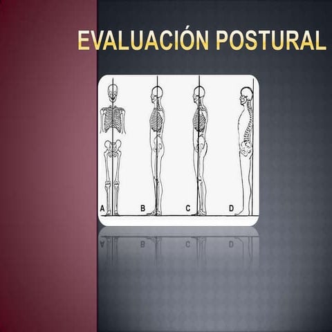 Evaluación postural