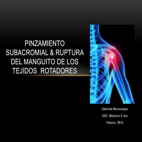 ortopedia pinzamiento subacromial y ruptura del manguito de tejidos rotadores