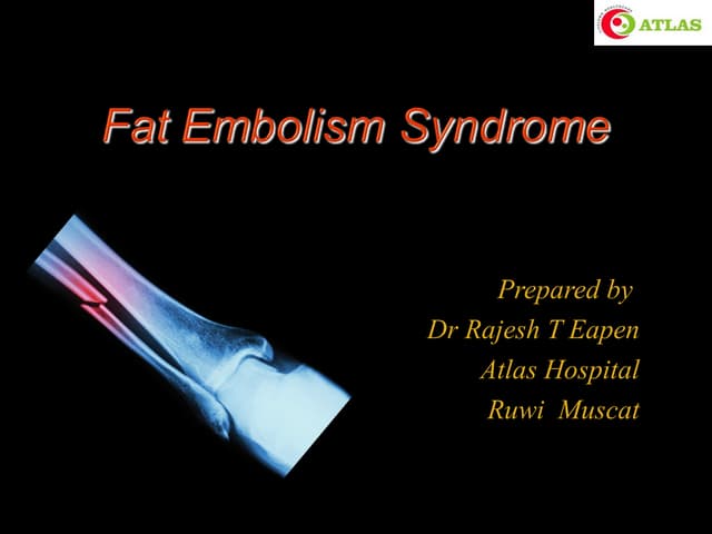 Fat embolism