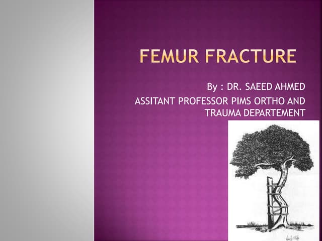 Femur fracture