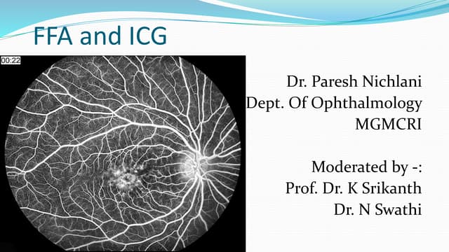 fundus fluorescein angiography V/S indocyanine green angiography
