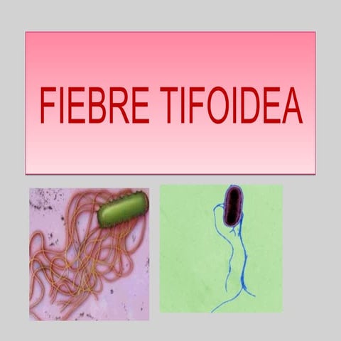 Fiebre tifoidea