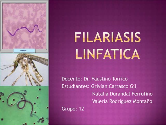Filariasis linfatica