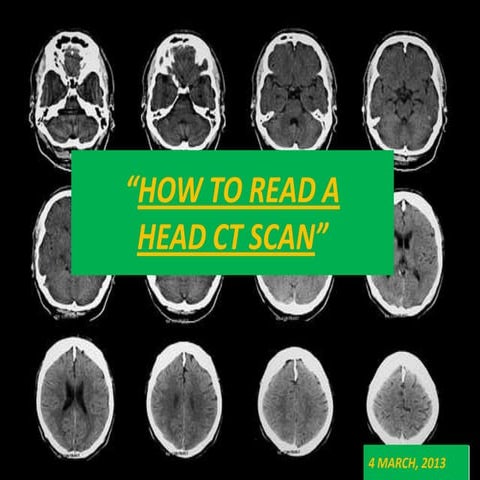 BASICS of CT Head
