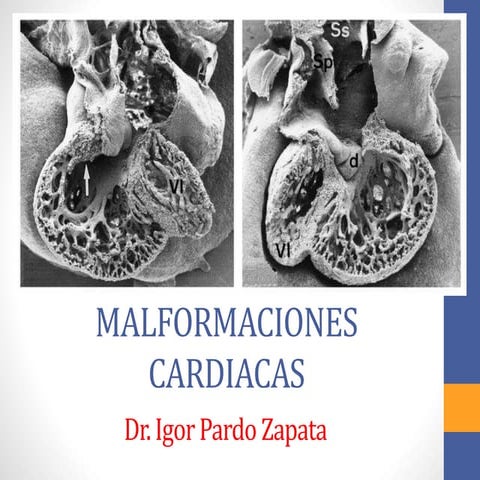 Dr. Igor Pardo Zapata. Malformaciones Cardíacas 2016. 