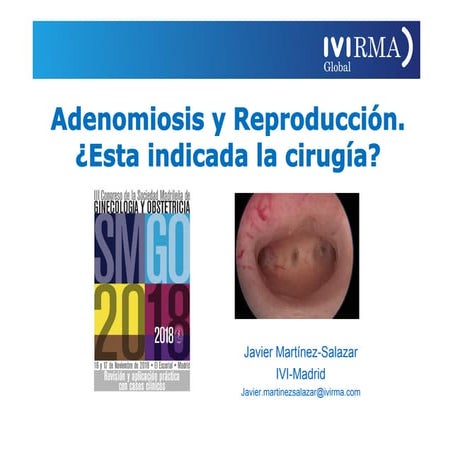 Adenomiosis y Reproducción.  ¿Está indicada la cirugía?