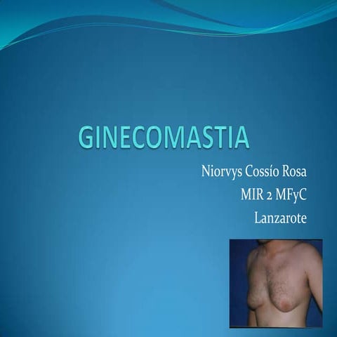 Ginecomastia