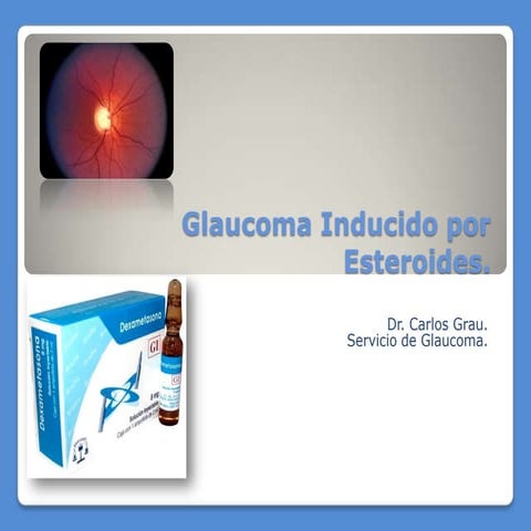 Glaucoma inducido por esteroides