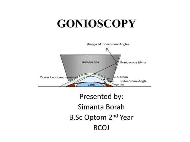 Gonioscopy
