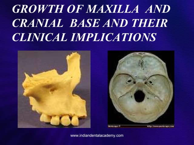 Growth of maxilla  /certified fixed orthodontic courses by Indian dental acad...