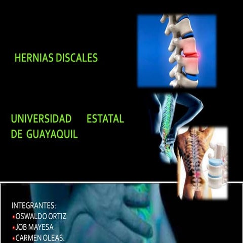 Hernias discales final