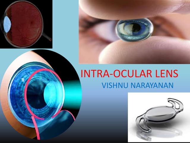 Intra ocular lens