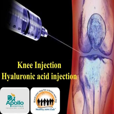 Intraartiular knee injection