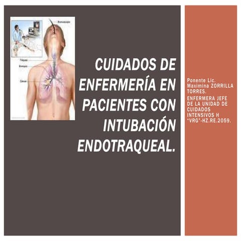 Intubación endotraqueal