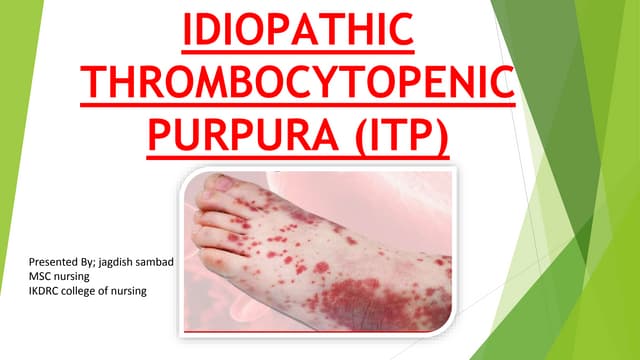 IDIOPATHIC THROMBOCYTOPENIC PURPURA  (ITP)