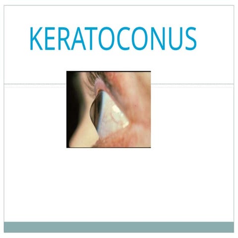 keratoconus final ppppppppppppppppppppppppppppppppppp