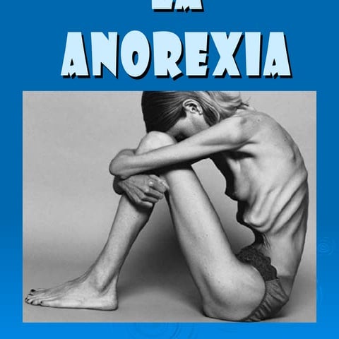 POWER POINT SOBRE LA ANOREXIA