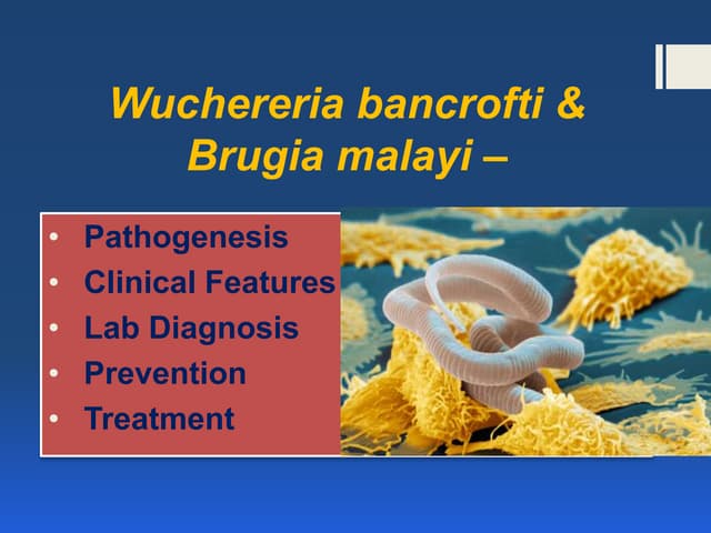 Wuchereria bancrofti - Filariasis