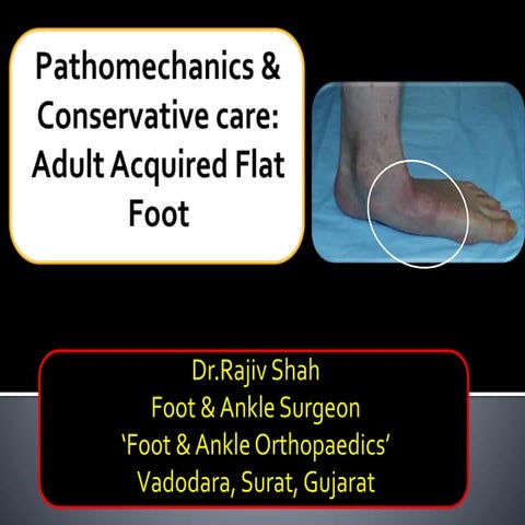 Lecture 25 shah flat foot conservative