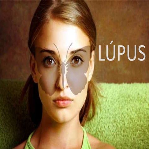 lupus eritematoso