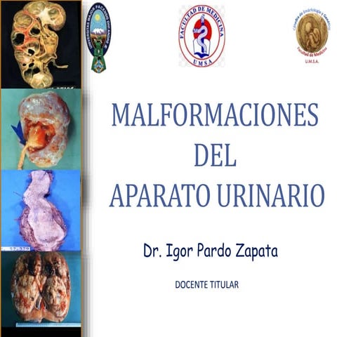 Malformaciones del Aparato Urinario. Dr. Igor Pardo Zapata 2017