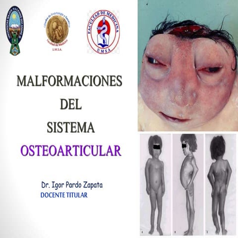Malformaciones del sistema esquelético-articular 2017