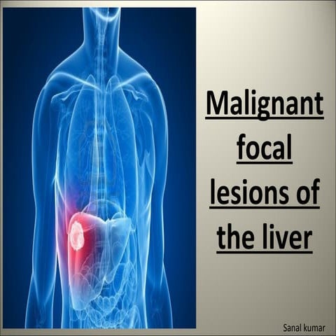 Focal malignant lesions of the liver.