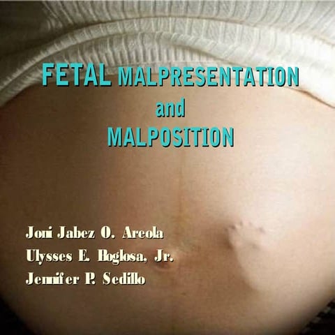 Malpresentation 110220081149-phpapp01