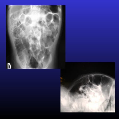 Manometria Anorectal Quito