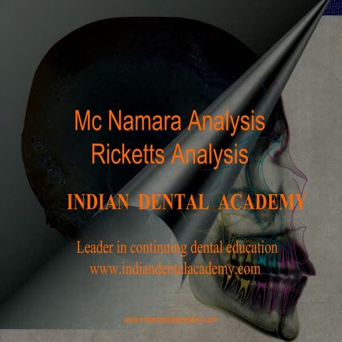 Mc namara analysis /certified fixed orthodontic courses by Indian dental acad...