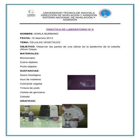 Microscopio. cebolla