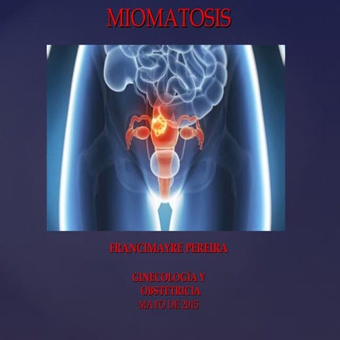 Miomatosis