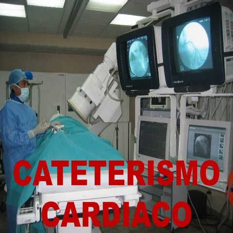 Cateterismo cardiaco