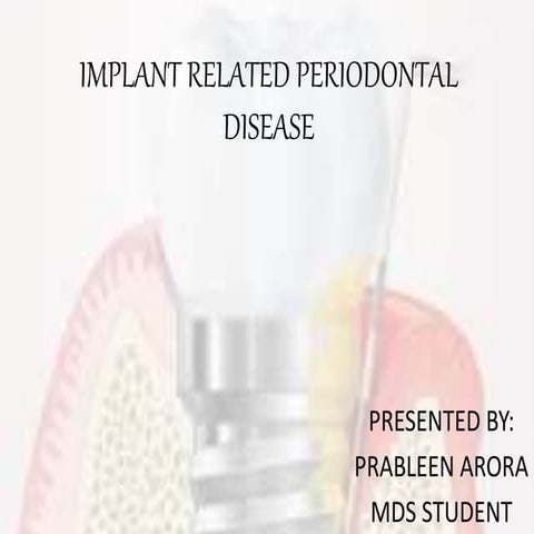 Implant related periodontal disease