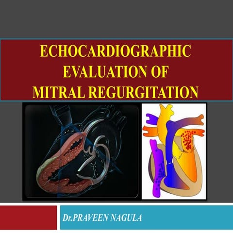 ECHOCARDIOGRAPHIC EVALUATION OF MITRAL VALVE DISEASE -MITRAL REGURGITATION