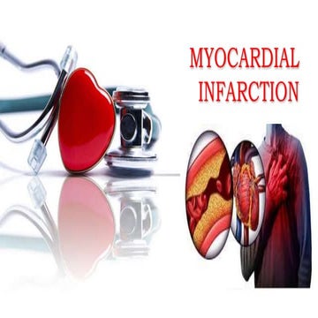 Myocardial infarction  