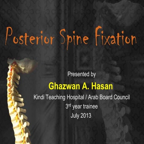 Posterior Spine Fixation