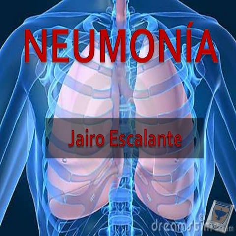 Neumonía