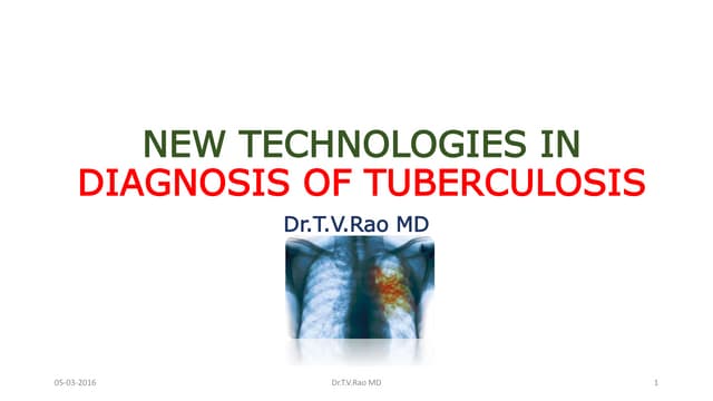 NEW TECHNOLOGIES IN   DIAGNOSIS OF TUBERCULOSIS 