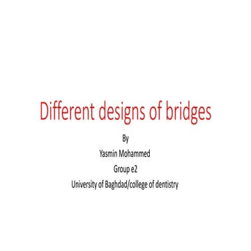 different designs of dental bridges