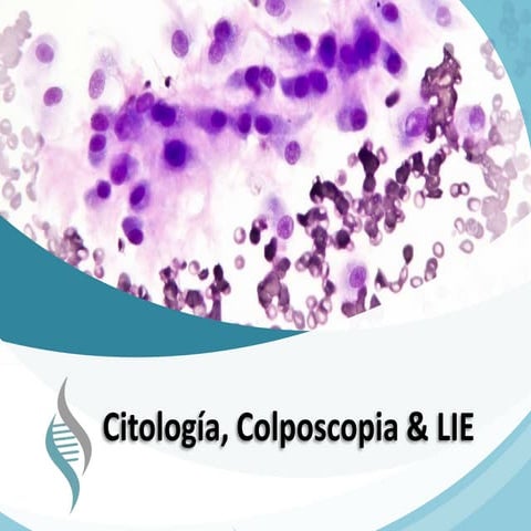 Normatecnicaparaladetecciontempranadelcancercervicouterino 150205213643-conve...