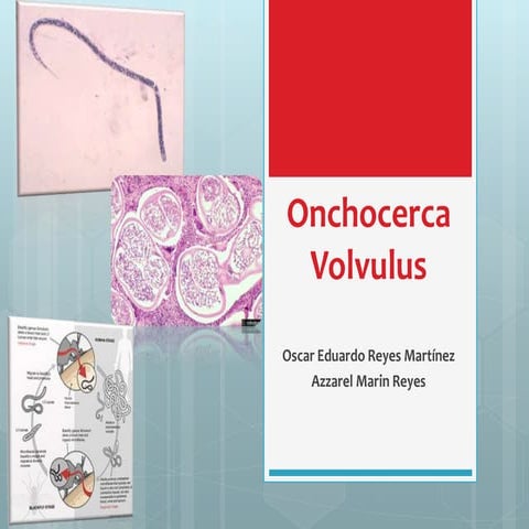 onchocercavolvulus-140927145102-phpapp02.pdf