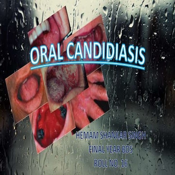 Oral candidiasis 